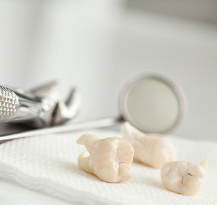 Extracted teeth on a table