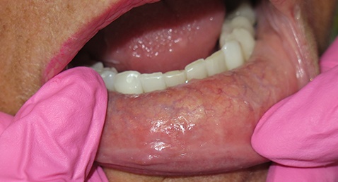 Closeup of healthy smiles after dental care