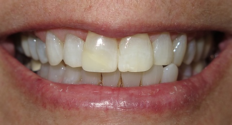 Healthy smile after dental treatment
