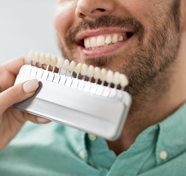 Closeup of smile compared with porcelain veneer shade chart