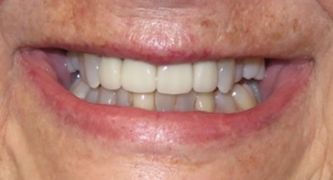 crown 9 after