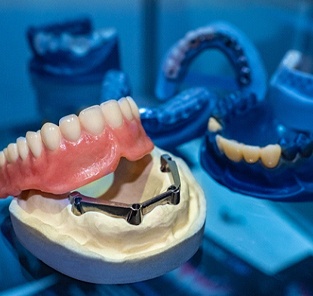 implant dentures in Norton Shores