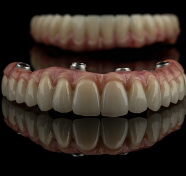 Implant denture for upper arch resting on reflective surface