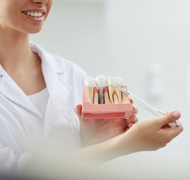 Dentist pointing to dental implant model