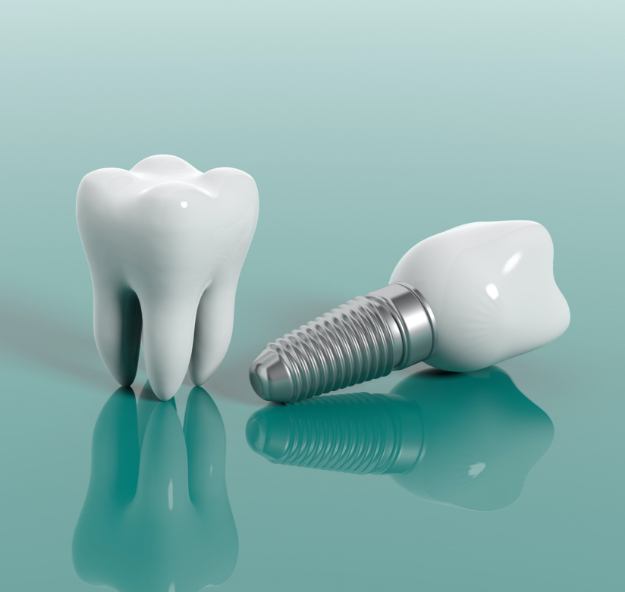 Animated tooth and dental implant supported dental crown