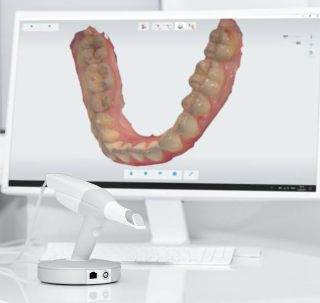 Digital bite impressions on chairside computer