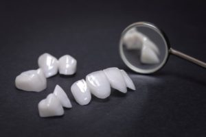 veneers ready to be placed at a dental office