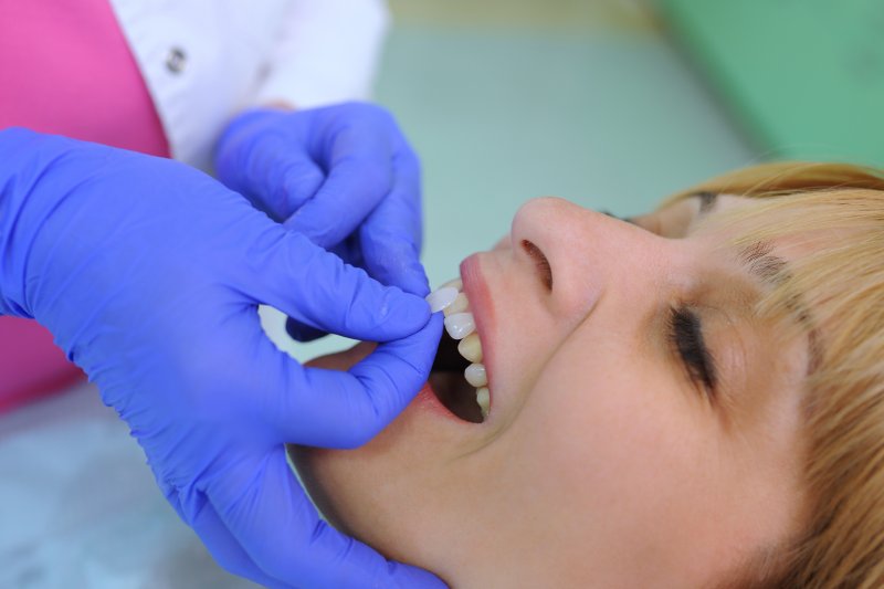 Woman having veneers placed on her teeth